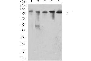 VCAM1 antibody  (AA 25-183)