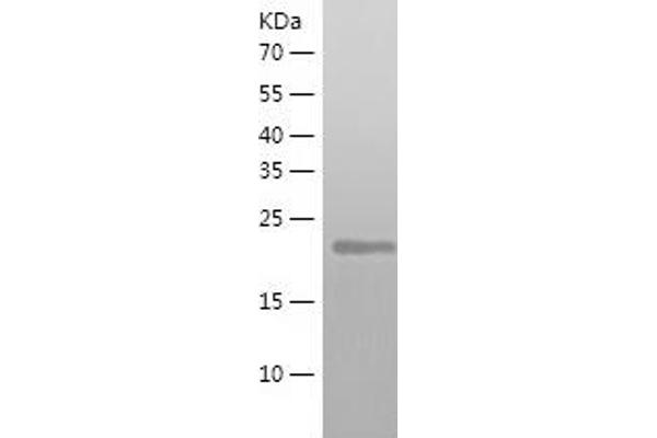 ATG10 Protein (AA 1-220) (His tag)