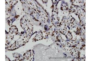 Image no. 4 for anti-TATA Box Binding Protein Associated Factor 11 (TAF11) (AA 158-211) antibody (ABIN598957) (TAF11 antibody  (AA 158-211))