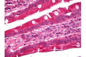 Anti-GUCY1A3 / Guanylyl Cyclase Alpha 1 antibody IHC of human small intestine. (GUCY1A1 antibody)