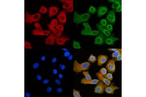 ABIN6258542 and ABIN6274916 staining HepG2 cells by IF/ICC.