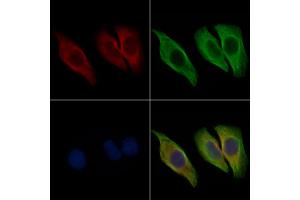 ABIN6265399 and ABIN6267024 staining Hela cells by IF/ICC. (SDC4 antibody  (C-Term))
