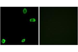 Immunofluorescence analysis of A549 cells, using TAS2R39 Antibody. (TAS2R39 antibody  (AA 218-267))