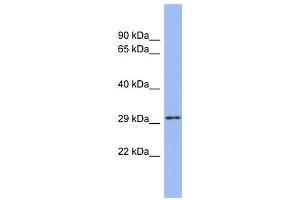 U2AF1 antibody used at 1 ug/ml to detect target protein. (U2AF1 antibody  (N-Term))