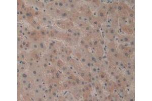 Detection of CD161 in Human Liver Tissue using Polyclonal Antibody to Cluster Of Differentiation 161 (CD161) (CD161 antibody  (AA 73-188))
