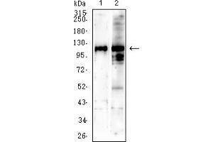 Western blot analysis using SALL4 mouse mAb against NIH/3T3 (1) C2C12 (2) cell lysate. (SALL4 antibody  (AA 96-359))