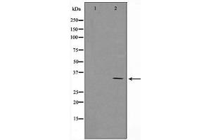 Western blot analysis of Cyclin D1 expression in MCF7 whole cell lysates,The lane on the left is treated with the antigen-specific peptide. (Cyclin D1 antibody  (C-Term))