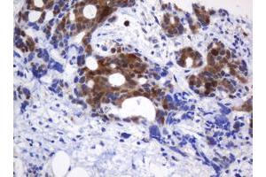 Image no. 2 for anti-Cytidine Monophosphate (UMP-CMP) Kinase 1, Cytosolic (CMPK1) antibody (ABIN1497546) (Cytidine Monophosphate (UMP-CMP) Kinase 1, Cytosolic (CMPK1) antibody)