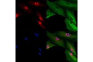 ABIN6260755 and ABIN6278972 staining  cells by IF/ICC. (CENPH antibody  (N-Term))