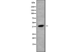Western blot analysis Olfactory receptor 52K1 using 293 whole cell lysates (OR52K1 antibody)