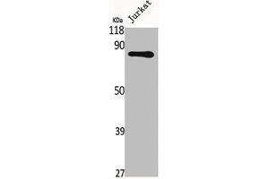 Western Blot analysis of Jurkat cells using Fyb Polyclonal Antibody (FYB1 antibody  (C-Term))