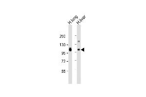 All lanes : Anti-AOC3 Antibody (Center) at 1:2000 dilution Lane 1: human lung lysate Lane 2: human liver lysate Lysates/proteins at 20 μg per lane. (AOC3 antibody  (AA 613-640))