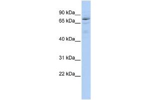 WB Suggested Anti-HIC1 Antibody Titration:  0. (HIC1 antibody  (Middle Region))