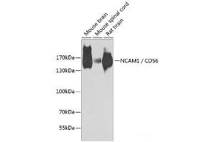 Western blot analysis of extracts of various cell lines using NCAM1 / CD56 Polyclonal Antibody at dilution of 1:1000. (CD56 antibody)