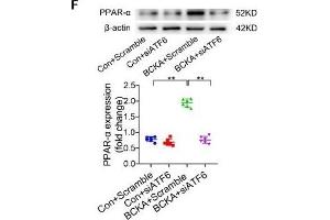 BCAA increase PPAR-α expression in a GCN2/ATF6 pathway-dependent manner.