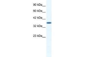 WB Suggested Anti-ANXA3 Antibody Titration:  1. (Annexin A3 antibody  (C-Term))