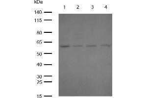 Western Blotting (WB) image for anti-V-Yes-1 Yamaguchi Sarcoma Viral Oncogene Homolog 1 (YES1) antibody (ABIN7607008)
