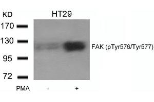 Western blot analysis of extracts from HT29 cells untreated or treated with PMA using FAK(phospho-Tyr576/Tyr577) Antibody. (FAK antibody  (pTyr576, pTyr577))