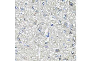 Immunohistochemistry of paraffin-embedded rat brain using GFPT1 antibody at dilution of 1:100 (x40 lens). (GFPT1 antibody)