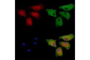 ABIN6266264 and ABIN6277421 staining  cells by IF/ICC.