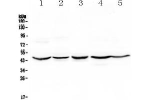 Western blot analysis of HMBS using anti-HMBS antibody .
