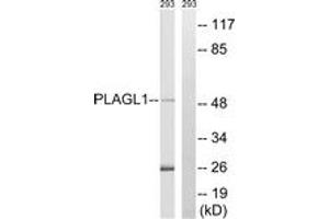 Western blot analysis of extracts from 293 cells, using PLAGL1 Antibody. (PLAGL1 antibody  (AA 311-360))