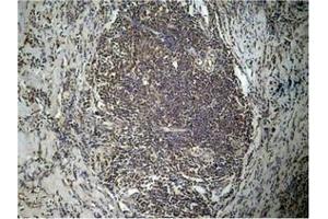 Immunohistochemistry (IHC) image for anti-Histone Cluster 1, H3a (HIST1H3A) (H3K27me2) antibody (ABIN7138397)