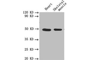 Western blot All lanes: PLAU antibody at 1. (PLAU antibody  (AA 21-173))