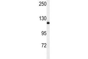 NEDD4 antibody  (AA 1288-1319)