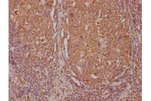 Immunohistochemistry (IHC) image for anti-Protein tyrosine Phosphatase, Receptor Type, C (PTPRC) (AA 24-575) antibody (ABIN7167502)