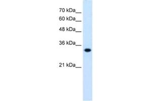 Western Blotting (WB) image for anti-3-Hydroxymethyl-3-Methylglutaryl-CoA Lyase (HMGCL) antibody (ABIN2462455) (HMGCL antibody)