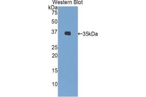 Western blot analysis of the recombinant protein. (Insulin antibody  (AA 88-108))