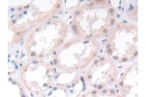Detection of ST14 in Human Kidney Tissue using Monoclonal Antibody to Suppression Of Tumorigenicity 14 (ST14) (APLP2 antibody  (AA 607-852))