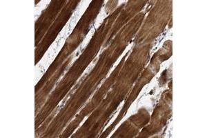 Immunohistochemical staining of human skeletal muscle with SOBP polyclonal antibody  shows strong cytoplasmic positivity in myocytes at 1:200-1:500 dilution.