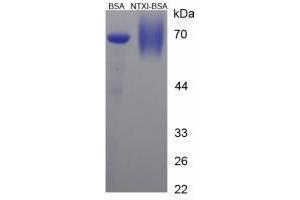 Image no. 3 for Cross Linked N-Telopeptide of Type I Collagen (NTX-I) peptide (BSA) (ABIN5665958) (Cross Linked N-Telopeptide of Type I Collagen (NTX-I) peptide (BSA))