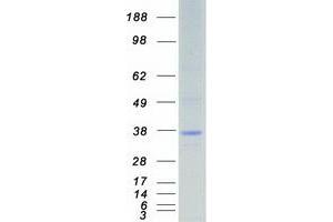 Validation with Western Blot (STK16 Protein (Transcript Variant 1) (Myc-DYKDDDDK Tag))