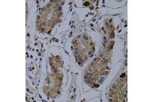 Immunohistochemistry of paraffin-embedded human stomach using TNFRSF6B antibody (ABIN5970241) at dilution of 1/200 (40x lens). (TNFRSF6B antibody)