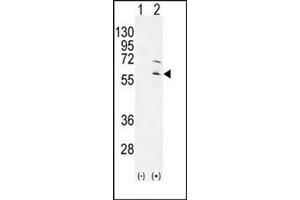 Western blot analysis of RPS6KL1 (arrow) using RPS6KL1 Antibody .
