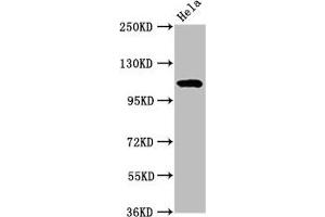 Western Blot Positive WB detected in: Hela whole cell lysate All lanes:NAT10 antibody at 7 μg/mL Secondary Goat polyclonal to rabbit IgG at 1/50000 dilution Predicted band size: 116, 108 kDa Observed band size: 116 kDa (NAT1 antibody  (AA 909-1025))