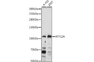 Western blot analysis of extracts of various cell lines, using A antibody (ABIN7265768) at 1:1000 dilution. (ATP12A antibody  (AA 890-980))