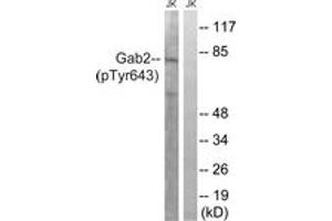 Western blot analysis of extracts from Jurkat cells treated with IFN 2500U/ML 30', using Gab2 (Phospho-Tyr643) Antibody. (GAB2 antibody  (pTyr643))