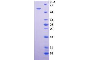 Image no. 1 for Tumor Necrosis Factor Receptor Superfamily, Member 10b (TNFRSF10B) (AA 234-435) (Active) protein (His tag,GST tag) (ABIN6239778)