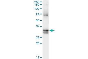 Immunoprecipitation of NIT1 transfected lysate using anti-NIT1 monoclonal antibody and Protein A Magnetic Bead , and immunoblotted with NIT1 monoclonal antibody. (Nitrilase 1 antibody  (AA 228-327))