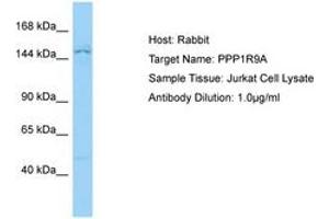Image no. 1 for anti-Protein Phosphatase 1, Regulatory (Inhibitor) Subunit 9A (PPP1R9A) (N-Term) antibody (ABIN6750131) (PPP1R9A antibody  (N-Term))