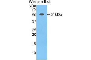 Western blot analysis of the recombinant protein. (TFAM antibody  (AA 43-244))