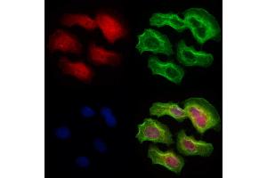 ABIN6265289 and ABIN6273076 staining Hela cells by IF/ICC.