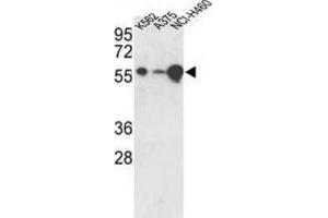 Western Blotting (WB) image for anti-Ubiquitin Specific Peptidase 3 (USP3) antibody (ABIN3001468)