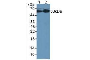 Western blot analysis of (1) Human HepG2 Cells and (2) Human HeLa cells. (Catalase antibody  (AA 80-239))