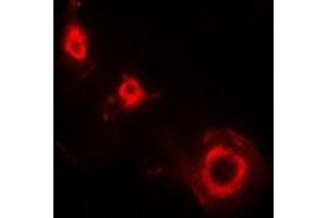 Immunofluorescent analysis of Ferritin L staining in HepG2 cells. (Ferritin L antibody)