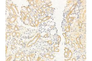 ABIN6261605 and ABIN6268755 at 1/100 staining Rat kidney tissue by IHC-P. (EpCAM antibody  (Internal Region))